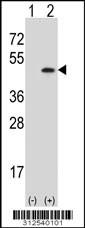 Western blot analysis of his-tag SERPINB1 (arrow) using his tag antibody. 293 cell lysates (2 ug/lane) either nontransfected (Lane 1) or transiently transfected with the SERPINB1 gene