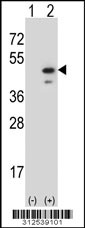 Western blot analysis of his-tag septin 1(SEPT1) (arrow) using his tag antibody. 293 cell lysates (2 ug/lane) either nontransfected (Lane 1) or transiently transfected with the septin 1(SEPT1) gene