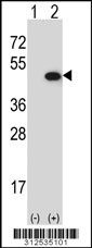 Western blot analysis of his-tag ERCC1 (arrow) using his tag antibody. 293 cell lysates (2 ug/lane) either nontransfected (Lane 1) or transiently transfected with the ERCC1 gene