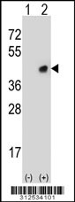 Western blot analysis of his-tag EPYC (arrow) using his tag antibody. 293 cell lysates (2 ug/lane) either nontransfected (Lane 1) or transiently transfected with the EPYC gene