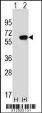Western blot analysis of his-tag EPHX2 (arrow) using his tag antibody. 293 cell lysates (2 ug/lane) either nontransfected (Lane 1) or transiently transfected with the EPHX2 gene