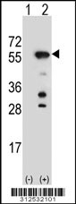Western blot analysis of his-tag EPB49 (arrow) using his tag antibody. 293 cell lysates (2 ug/lane) either nontransfected (Lane 1) or transiently transfected with the EPB49 gene