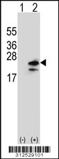 Western blot analysis of his-tag EMP3 (arrow) using his tag antibody. 293 cell lysates (2 ug/lane) either nontransfected (Lane 1) or transiently transfected with the EMP3 gene