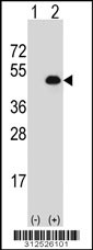 Western blot analysis of his-tag ELK3 (arrow) using his tag antibody. 293 cell lysates (2 ug/lane) either nontransfected (Lane 1) or transiently transfected with the ELK3 gene