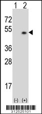 Western blot analysis of his-tag ELF3 (arrow) using his tag antibody. 293 cell lysates (2 ug/lane) either nontransfected (Lane 1) or transiently transfected with the ELF3 gene