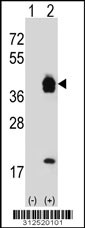 Western blot analysis of his-tag EFNB2 (arrow) using his tag antibody. 293 cell lysates (2 ug/lane) either nontransfected (Lane 1) or transiently transfected with the EFNB2 gene