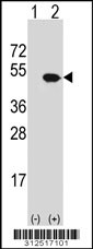 Western blot analysis of his-tag EEF1G (arrow) using his tag antibody. 293 cell lysates (2 ug/lane) either nontransfected (Lane 1) or transiently transfected with the EEF1G gene