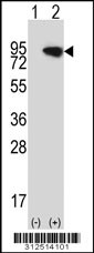 Western blot analysis of his-tag DYNC1I2 (arrow) using his tag antibody. 293 cell lysates (2 ug/lane) either nontransfected (Lane 1) or transiently transfected with the DYNC1I2 gene