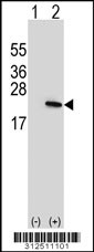 Western blot analysis of his-tag DR1 (arrow) using his tag antibody. 293 cell lysates (2 ug/lane) either nontransfected (Lane 1) or transiently transfected with the DR1 gene