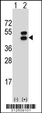 Western blot analysis of his-tag DPEP1 (arrow) using his tag antibody. 293 cell lysates (2 ug/lane) either nontransfected (Lane 1) or transiently transfected with the DPEP1 gene
