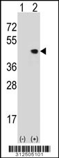 Western blot analysis of his-tag DLX3 (arrow) using his tag antibody. 293 cell lysates (2 ug/lane) either nontransfected (Lane 1) or transiently transfected with the DLX3 gene