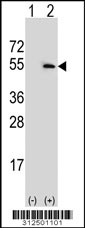 Western blot analysis of his-tag DDOST (arrow) using his tag antibody. 293 cell lysates (2 ug/lane) either nontransfected (Lane 1) or transiently transfected with the DDOST gene