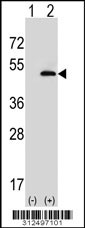 Western blot analysis of his-tag CYP2A7 (arrow) using his tag antibody. 293 cell lysates (2 ug/lane) either nontransfected (Lane 1) or transiently transfected with the CYP2A7 gene