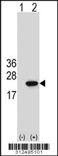 Western blot analysis of his-tag CYB5A (arrow) using his tag antibody. 293 cell lysates (2 ug/lane) either nontransfected (Lane 1) or transiently transfected with the CYB5A gene