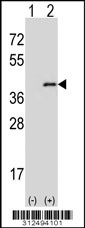 Western blot analysis of his-tag CTSO (arrow) using his tag antibody. 293 cell lysates (2 ug/lane) either nontransfected (Lane 1) or transiently transfected with the CTSO gene