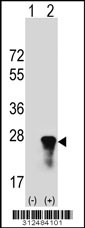 Western blot analysis of his-tag CRYGS (arrow) using his tag antibody. 293 cell lysates (2 ug/lane) either nontransfected (Lane 1) or transiently transfected with the CRYGS gene