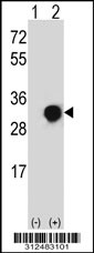Western blot analysis of his-tag CRYGD (arrow) using his tag antibody. 293 cell lysates (2 ug/lane) either nontransfected (Lane 1) or transiently transfected with the CRYGD gene