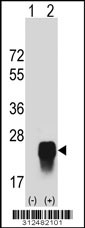 Western blot analysis of his-tag CRYGB (arrow) using his tag antibody. 293 cell lysates (2 ug/lane) either nontransfected (Lane 1) or transiently transfected with the CRYGB gene