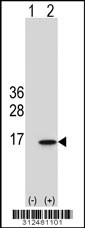 Western blot analysis of his-tag CRYGA (arrow) using his tag antibody. 293 cell lysates (2 ug/lane) either nontransfected (Lane 1) or transiently transfected with the CRYGA gene