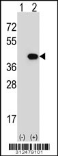 Western blot analysis of his-tag AKR1C2 (arrow) using his tag antibody. 293 cell lysates (2 ug/lane) either nontransfected (Lane 1) or transiently transfected with the AKR1C2 gene