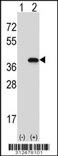 Western blot analysis of his-tag TOR1A (arrow) using his tag antibody. 293 cell lysates (2 ug/lane) either nontransfected (Lane 1) or transiently transfected with the TOR1A gene