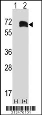 Western blot analysis of his-tag SCARB2 (arrow) using his tag antibody. 293 cell lysates (2 ug/lane) either nontransfected (Lane 1) or transiently transfected with the SCARB2 gene
