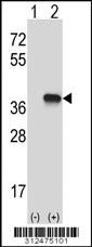 Western blot analysis of his-tag MS4A1 (arrow) using his tag antibody. 293 cell lysates (2 ug/lane) either nontransfected (Lane 1) or transiently transfected with the MS4A1 gene