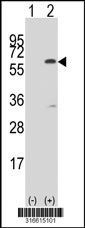 Western blot analysis of his-tag KRT38 (arrow) using his tag antibody. 293T cell lysates (2 ug/lane) either nontransfected (Lane 1) or transiently transfected with the KRT38 gene‘