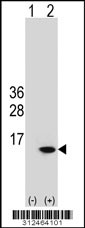 Western blot analysis of his-tag E2F2 (arrow) using his tag antibody. 293 cell lysates (2 ug/lane) either nontransfected (Lane 1) or transiently transfected with the E2F2 gene