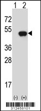Western blot analysis of his-tag DHPS (arrow) using his tag antibody. 293 cell lysates (2 ug/lane) either nontransfected (Lane 1) or transiently transfected with the DHPS gene