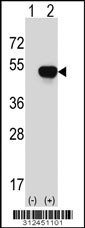 Western blot analysis of his-tag CTBP1 (arrow) using his tag antibody. 293 cell lysates (2 ug/lane) either nontransfected (Lane 1) or transiently transfected with the CTBP1 gene