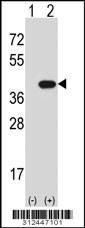 Western blot analysis of his-tag CRYM (arrow) using his tag antibody. 293 cell lysates (2 ug/lane) either nontransfected (Lane 1) or transiently transfected with the CRYM gene
