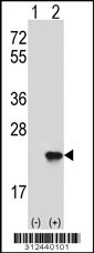 Western blot analysis of his-tag CDKN2D (arrow) using his tag antibody. 293 cell lysates (2 ug/lane) either nontransfected (Lane 1) or transiently transfected with the CDKN2D gene