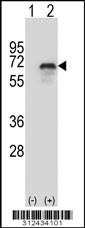 Western blot analysis of his-tag C8B (arrow) using his tag antibody. 293 cell lysates (2 ug/lane) either nontransfected (Lane 1) or transiently transfected with the C8B gene