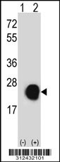 Western blot analysis of his-tag AP3S1 (arrow) using his tag antibody. 293 cell lysates (2 ug/lane) either nontransfected (Lane 1) or transiently transfected with the AP3S1 gene