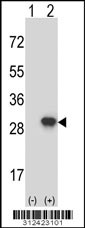 Western blot analysis of his-tag ERCC8 (arrow) using his tag antibody. 293 cell lysates (2 ug/lane) either nontransfected (Lane 1) or transiently transfected with the ERCC8 gene