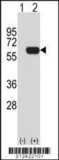 Western blot analysis of his-tag ENTPD3 (arrow) using his tag antibody. 293 cell lysates (2 ug/lane) either nontransfected (Lane 1) or transiently transfected with the ENTPD3 gene