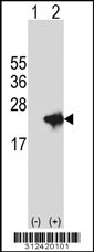 Western blot analysis of his-tag CRYAA (arrow) using his tag antibody. 293 cell lysates (2 ug/lane) either nontransfected (Lane 1) or transiently transfected with the CRYAA gene