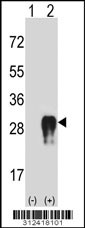 Western blot analysis of his-tag CRIP2 (arrow) using his tag antibody. 293 cell lysates (2 ug/lane) either nontransfected (Lane 1) or transiently transfected with the CRIP2 gene