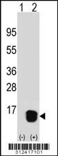 Western blot analysis of his-tag CRABP2 (arrow) using his tag antibody. 293 cell lysates (2 ug/lane) either nontransfected (Lane 1) or transiently transfected with the CRABP2 gene