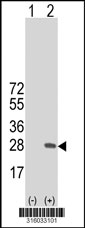 Western blot analysis of his-tag GPIHBP1 (arrow) using his tag antibody. 293T cell lysates (2 ug/lane) either nontransfected (Lane 1) or transiently transfected with the GPIHBP1 gene‘