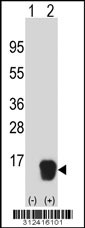 Western blot analysis of his-tag CRABP1 (arrow) using his tag antibody. 293 cell lysates (2 ug/lane) either nontransfected (Lane 1) or transiently transfected with the CRABP1 gene