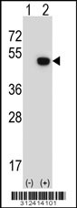 Western blot analysis of his-tag CPB1 (arrow) using his tag antibody. 293 cell lysates (2 ug/lane) either nontransfected (Lane 1) or transiently transfected with the CPB1 gene