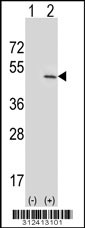 Western blot analysis of his-tag CPA3 (arrow) using his tag antibody. 293 cell lysates (2 ug/lane) either nontransfected (Lane 1) or transiently transfected with the CPA3 gene