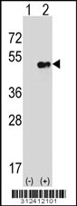 Western blot analysis of his-tag CPA2 (arrow) using his tag antibody. 293 cell lysates (2 ug/lane) either nontransfected (Lane 1) or transiently transfected with the CPA2 gene