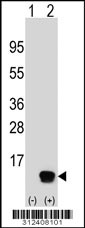 Western blot analysis of his-tag COX6B1 (arrow) using his tag antibody. 293 cell lysates (2 ug/lane) either nontransfected (Lane 1) or transiently transfected with the COX6B1 gene
