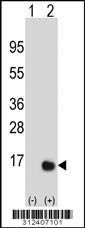 Western blot analysis of his-tag COX5B (arrow) using his tag antibody. 293 cell lysates (2 ug/lane) either nontransfected (Lane 1) or transiently transfected with the COX5B gene