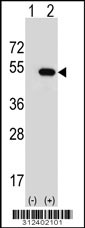 Western blot analysis of his-tag CNTFR (arrow) using his tag antibody. 293 cell lysates (2 ug/lane) either nontransfected (Lane 1) or transiently transfected with the CNTFR gene