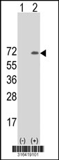 Western blot analysis of his-tag CBLL1 (arrow) using his tag antibody. 293T cell lysates (2 ug/lane) either nontransfected (Lane 1) or transiently transfected with the CBLL1 gene‘