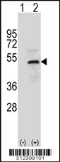 Western blot analysis of his-tag CLU (arrow) using his tag antibody. 293 cell lysates (2 ug/lane) either nontransfected (Lane 1) or transiently transfected with the CLU gene
